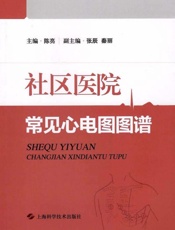 社区医院常见心电图图谱