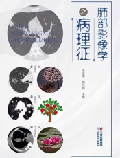 肺部影像学之病理征