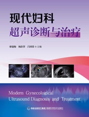 现代妇科超声诊断与治疗