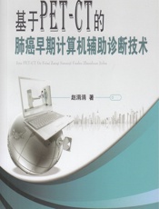 基于PET-CT的肺癌早期计算机辅助诊断技术 - 赵涓涓