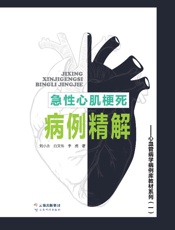 急性心肌梗死病例精解