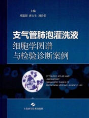 支气管肺泡灌洗液细胞学图谱与检验诊断案例