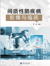间质性肺疾病影像与临床