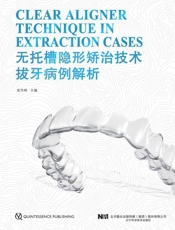 无托槽隐形矫治技术拔牙病例解析