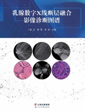 乳腺数字X 线断层融合影像诊断图谱