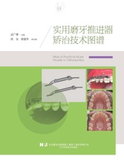 实用磨牙推进器矫治技术图谱
