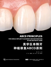 美学区单颗牙种植修复ABCD原则