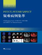 PETMR与SPECT疑难病例集萃