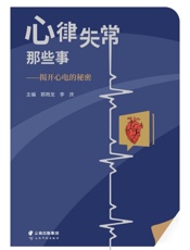 心律失常那些事：揭开心电的秘密