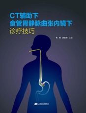 CT辅助下食管胃静脉曲张内镜下诊疗技巧