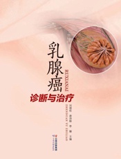 乳腺癌诊断与治疗
