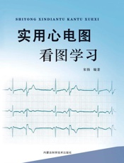 实用心电图看图学习